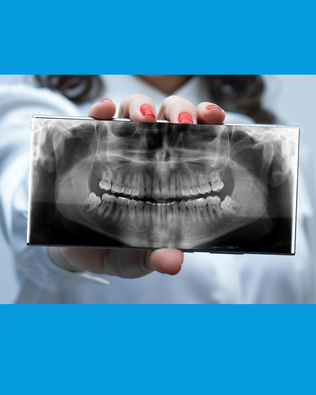 Radiografia Panorâmica